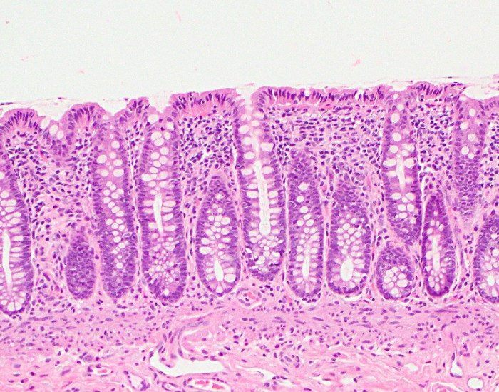 Ascp ht practice exam free