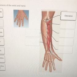 Correctly label the extensors of the wrist and hand.