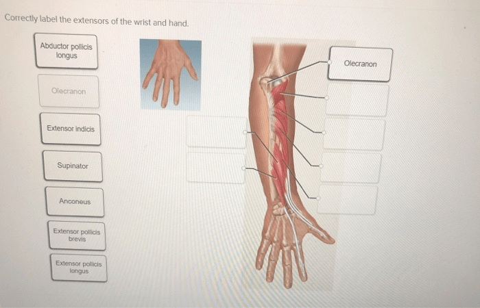 Correctly label the extensors of the wrist and hand.