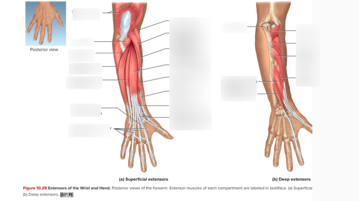 Correctly label the extensors of the wrist and hand.